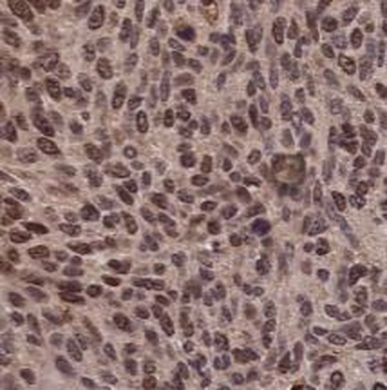 HNRNPD Rabbit Polyclonal Antibody
