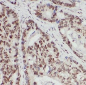 HNRNPF Antibody