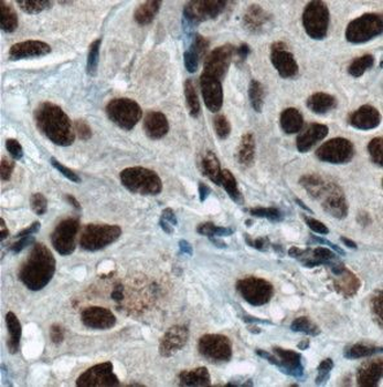 HNRNPH1 Antibody