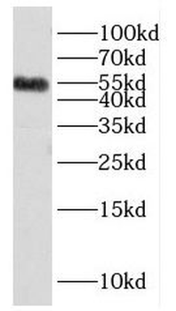 HNRNPK Rabbit Polyclonal Antibody
