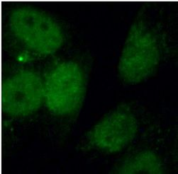 HNRNPK Rabbit Polyclonal Antibody