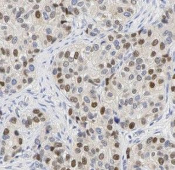 HNRNPK Rabbit Polyclonal Antibody