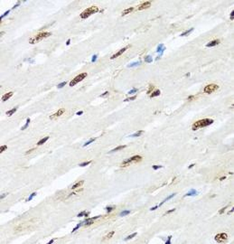 HNRNPR Antibody