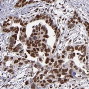 HNRNPUL1 Antibody