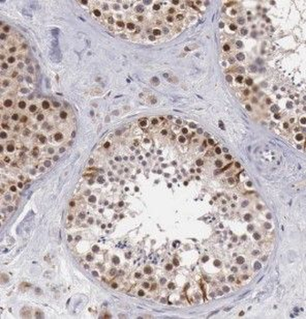 HOMEZ Antibody