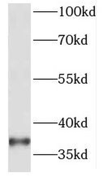 HOXA11 Rabbit Polyclonal Antibody