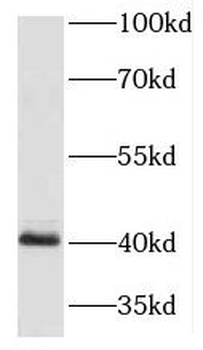 HOXA9 Antibody