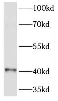 HOXB1 Rabbit Polyclonal Antibody