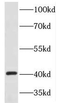 HOXB1 Rabbit Polyclonal Antibody
