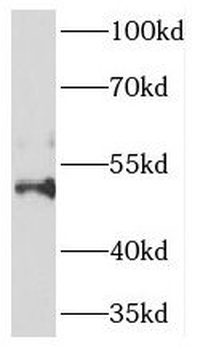 HOXC10 Rabbit Polyclonal Antibody