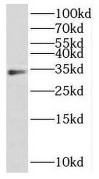 HOXD11 Rabbit Polyclonal Antibody