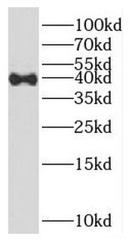 HOXD13 Antibody