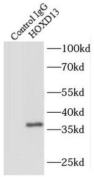 HOXD13 Antibody