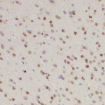 HOXD13 Antibody