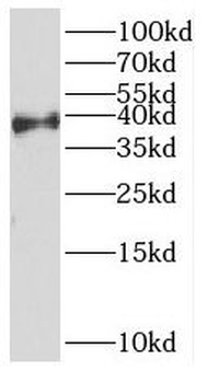 HOXD13 Antibody