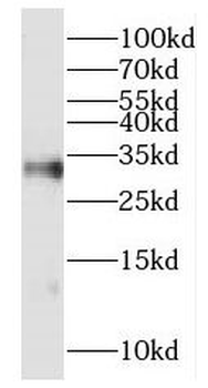 HOXD8 Antibody
