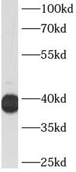 HP Mouse Monoclonal Antibody