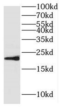 HPCAL4 Antibody
