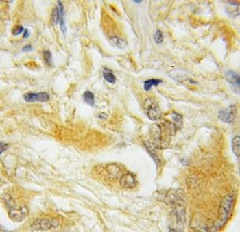 HPCAL4 Antibody