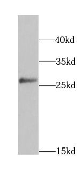 HPGD Antibody