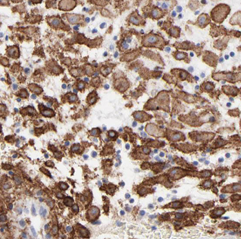 HPGDS Antibody
