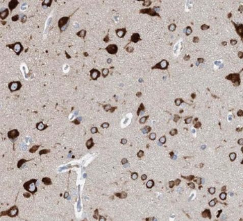 HPRT1 Antibody