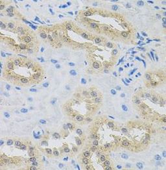 HPS1 Antibody