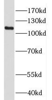 HPS3 Antibody