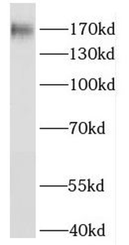 HRC Antibody