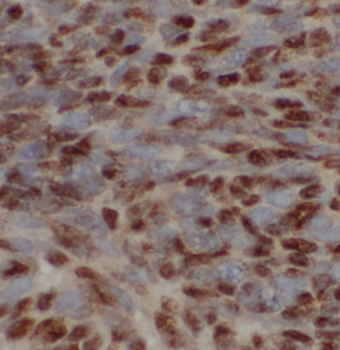 RIDA Antibody