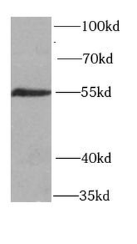 HS1BP3 Rabbit Polyclonal Antibody