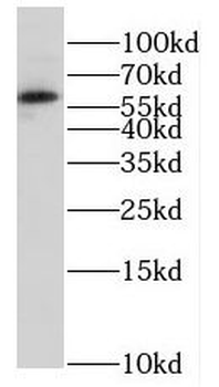 HSBP1 Rabbit Polyclonal Antibody