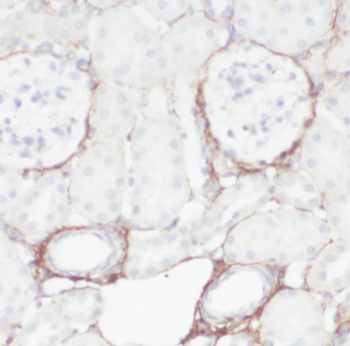 HSD17B11 Antibody
