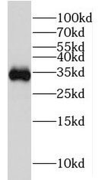 HSD17B11 Antibody