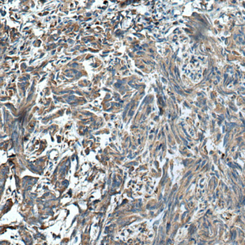 HSD17B4 Antibody