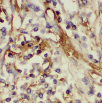 HSD17B6 Antibody