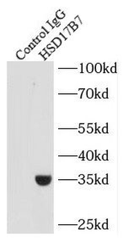HSD17B7 Antibody