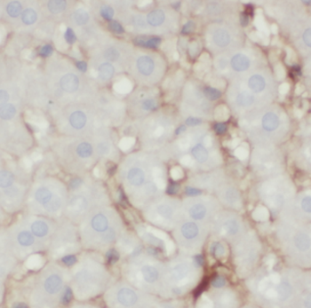 HSD17B7 Antibody