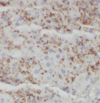 HSD17B8 Antibody