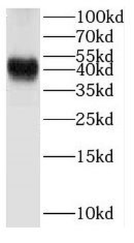 HSD3B2 Antibody