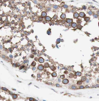 HSD3B2 Antibody
