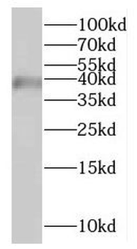 HSDL1 Antibody