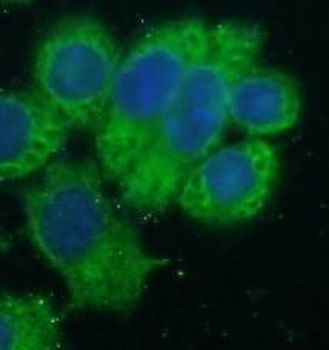 HSDL2 Antibody