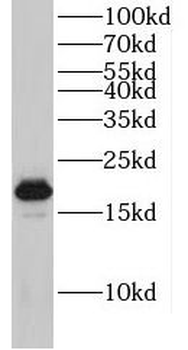 HSPB6 Rabbit Polyclonal Antibody