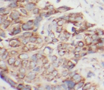 HSPB1 Antibody
