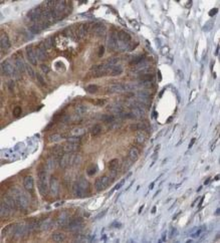 HSPD1 Antibody