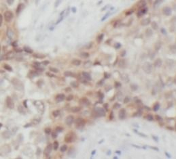 HSPA1A Mouse Monoclonal Antibody