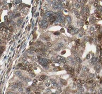 HSP90AA1 Antibody