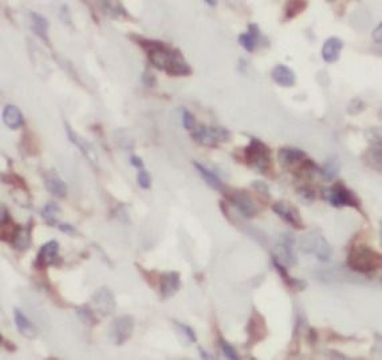 HSPA6 Antibody