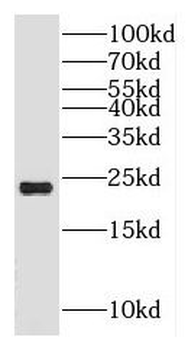 HSPB7 Antibody